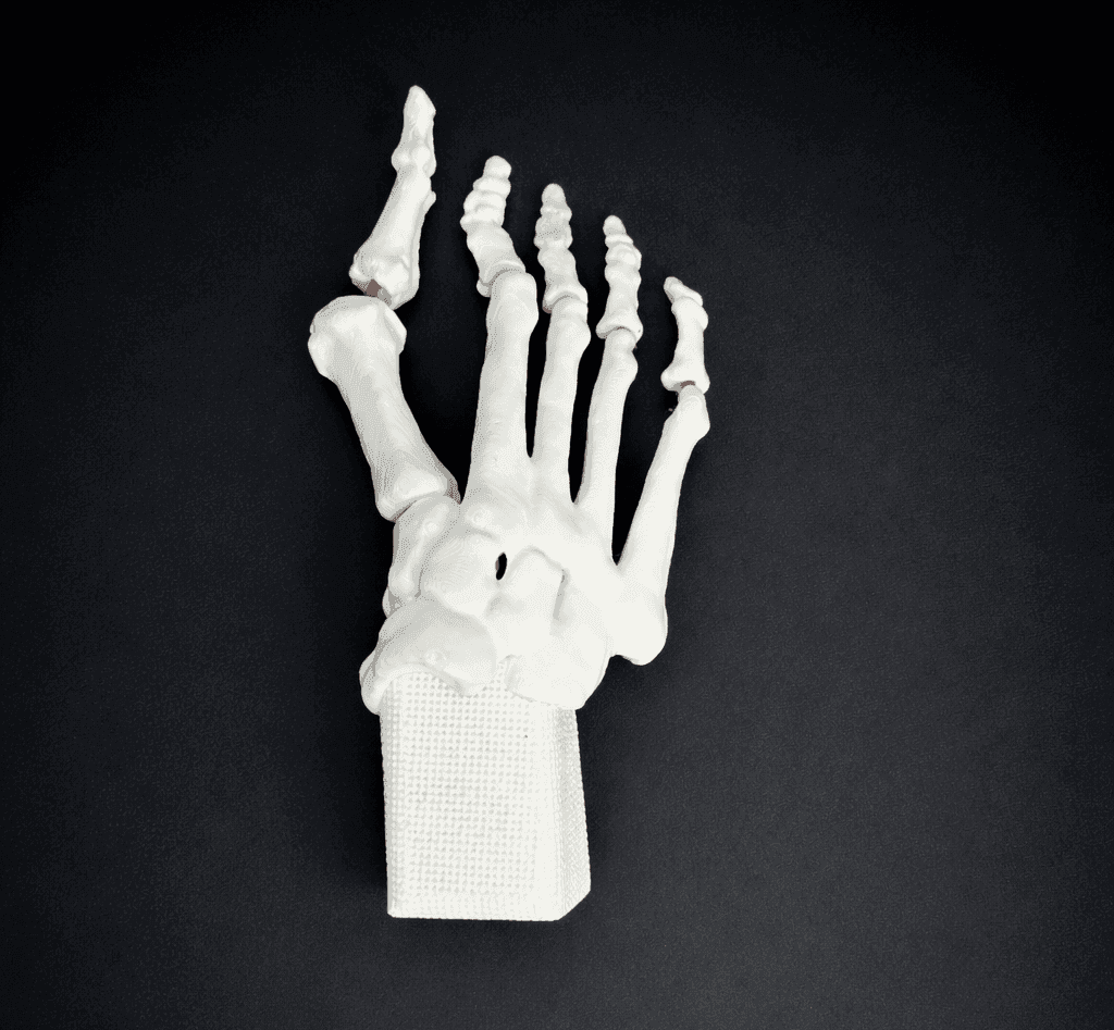 Hallux Valgus Bone Model – Mobile Joints