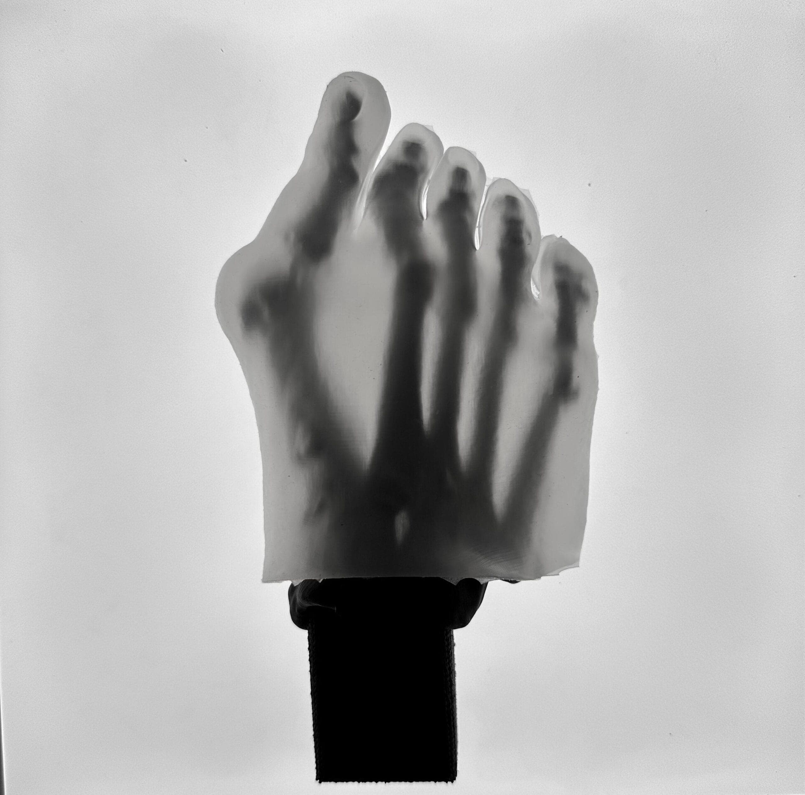 Hallux Valgus – Transparent Skin – Radioopaque Black Bone – Mobile Joints