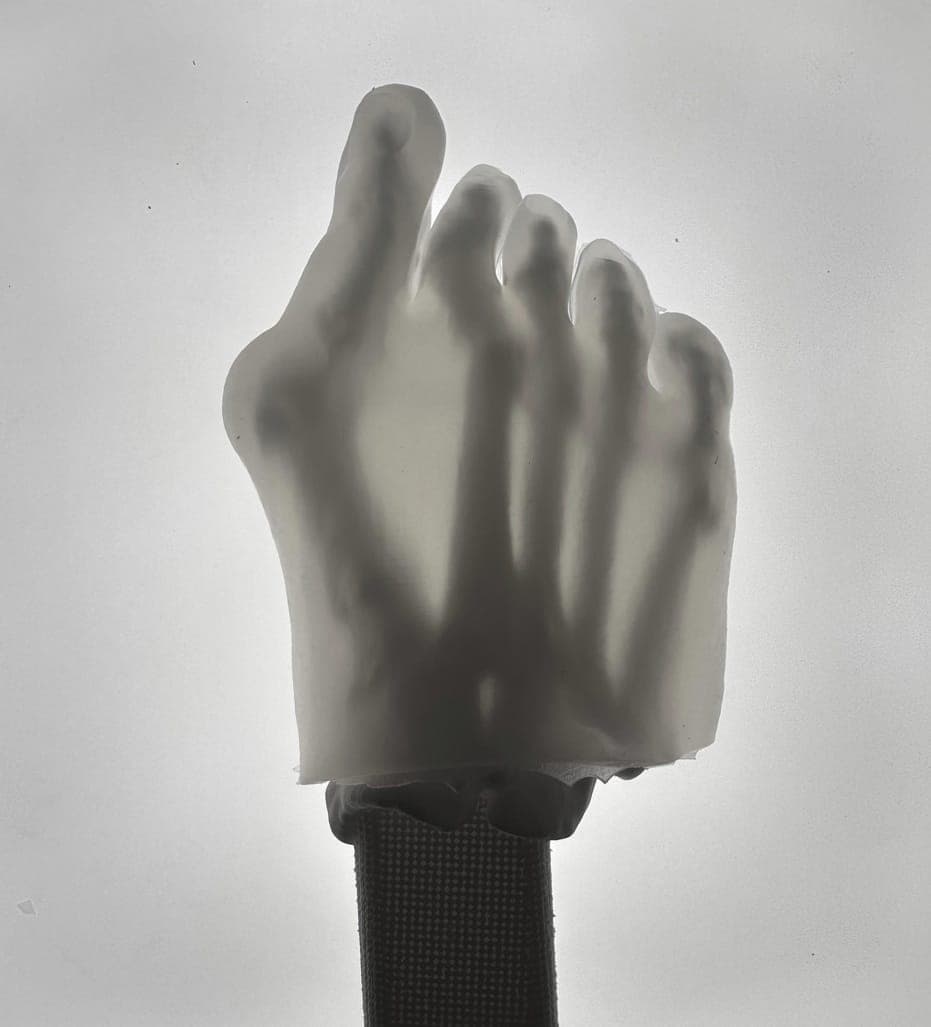 Hallux Valgus – Transparent Skin – Radioopaque White Bone – Mobile Joints