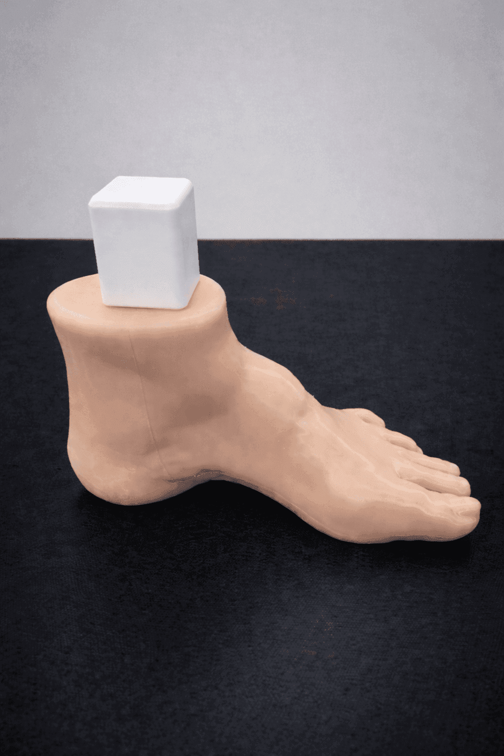 Pes Cavus – Radioopaque Bone – Opaque Skin