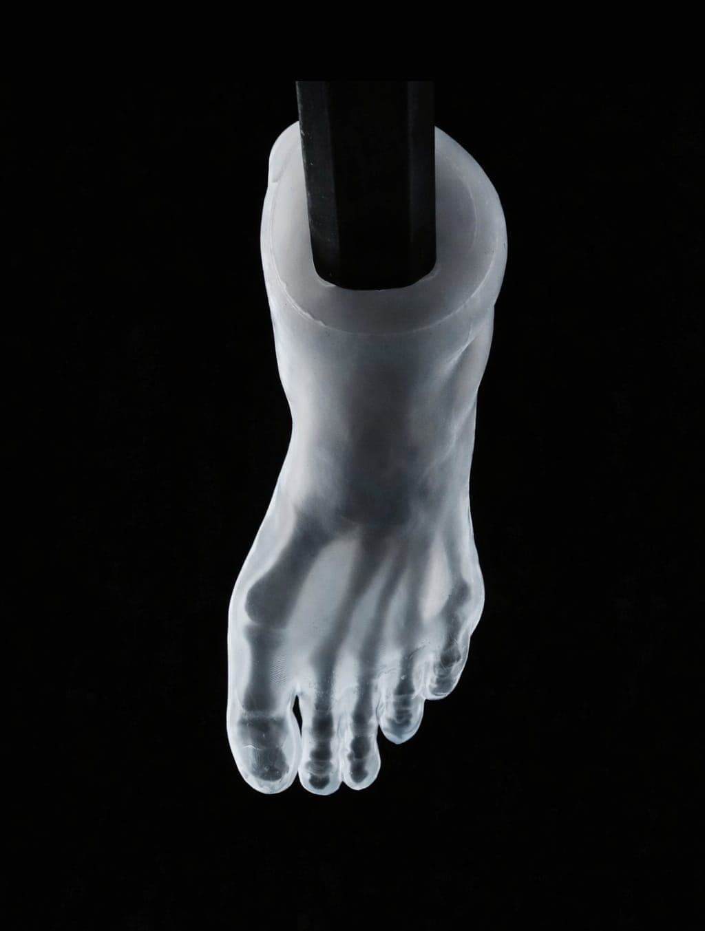 Pes Cavus – Transparent Skin – Radiolucent Black Bone