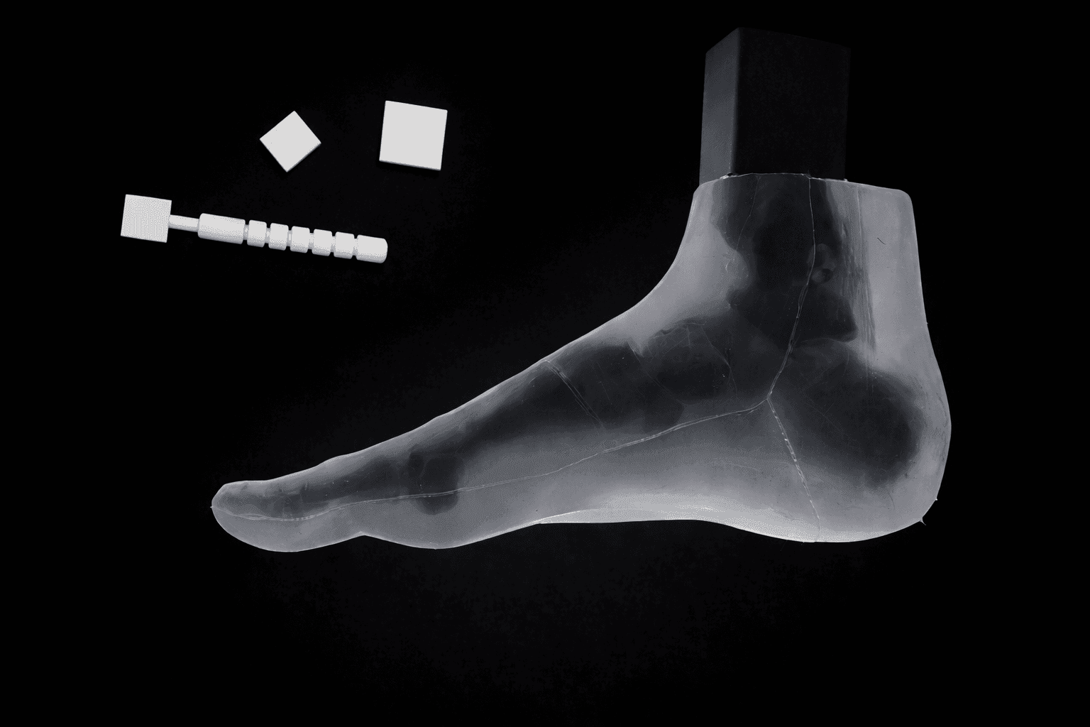 Pes Planus – Transparent Skin – Radioopaque Black Bone – Mobile Joints (including Evans & Cotton wedges)